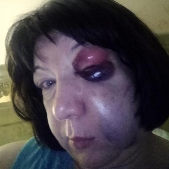 Нижегородка заявила в полицию, что ее изувечил муж-врач невролог